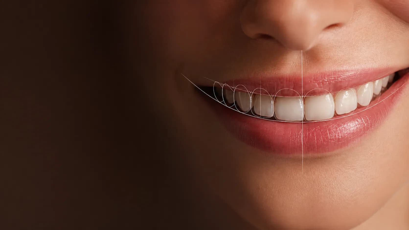 Diseño de sonrisa Digital Smile Design