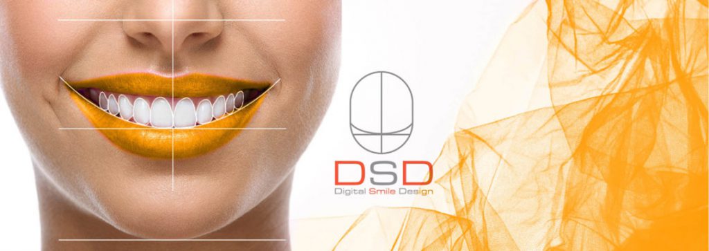 Diseño digital de la sonrisa