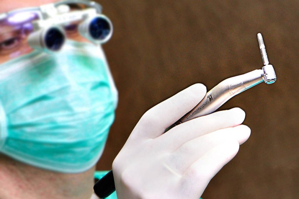 implantes-dentales-vicente-ferrer