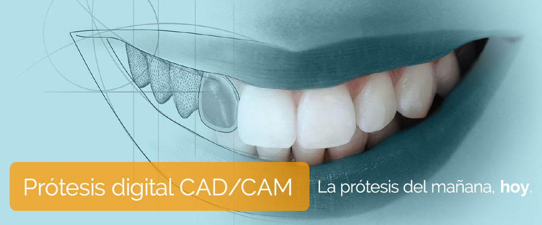 Prótesis digital Clínica Dental Dr. Vicente Ferrer