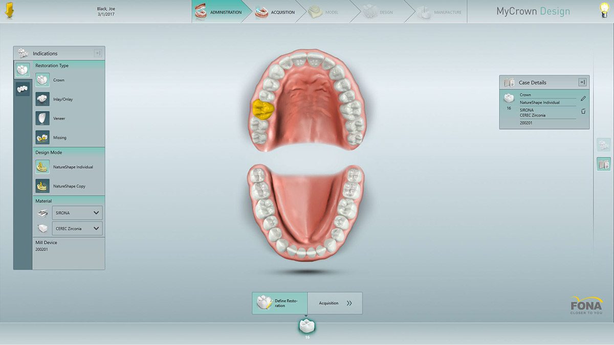 Odontología Digital CEREC Clínica Dental Dr. Vicente Ferrer