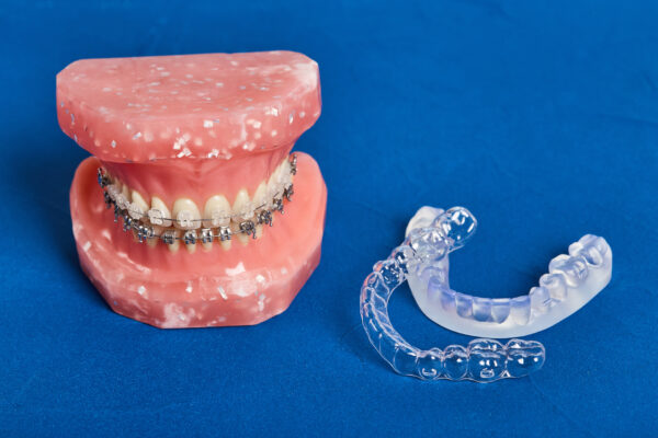 ortodoncia en Alcantarilla