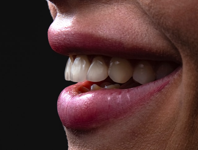 implantes alcantarilla